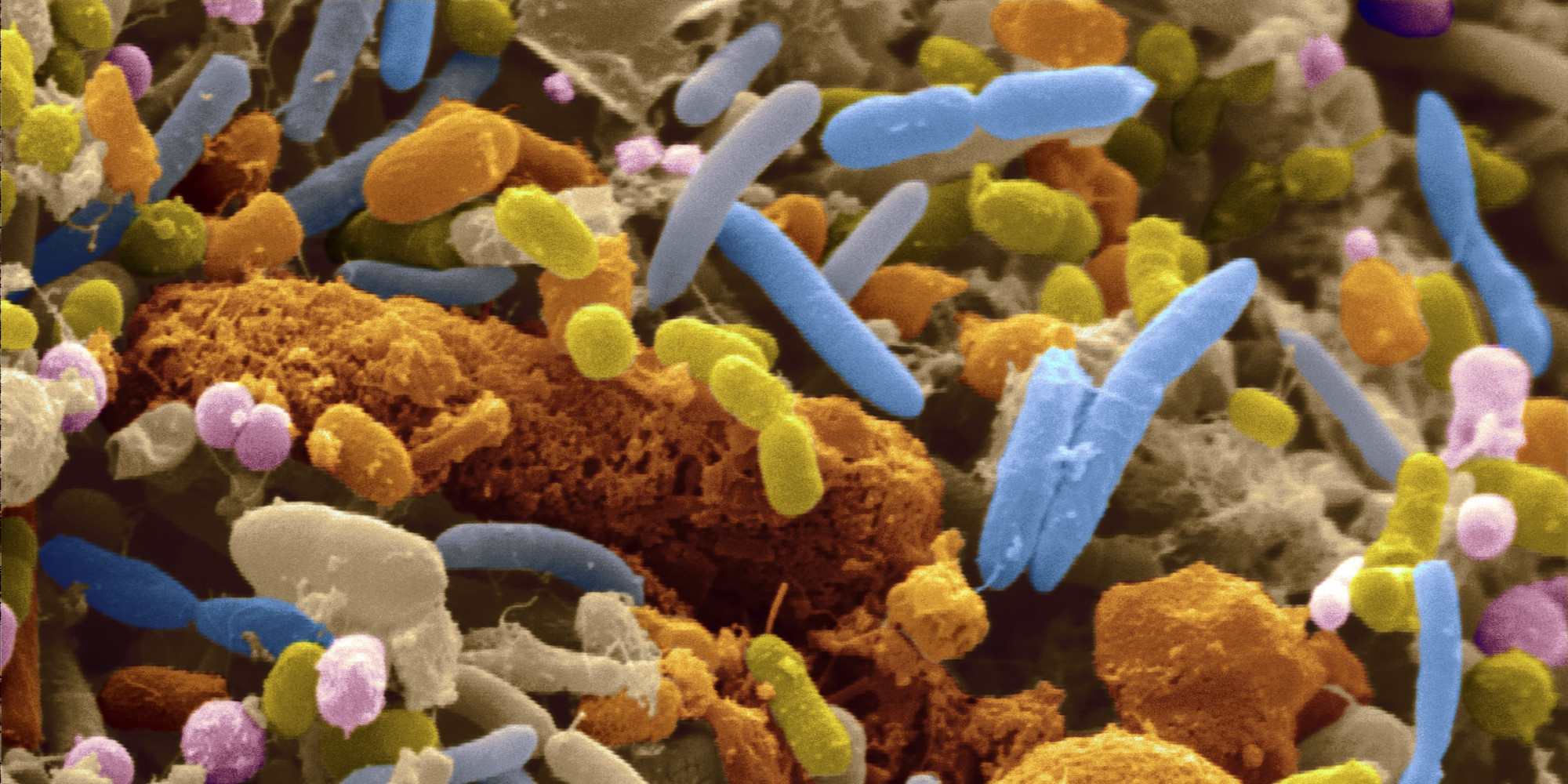 Love Your Gut Bacteria for Your Health