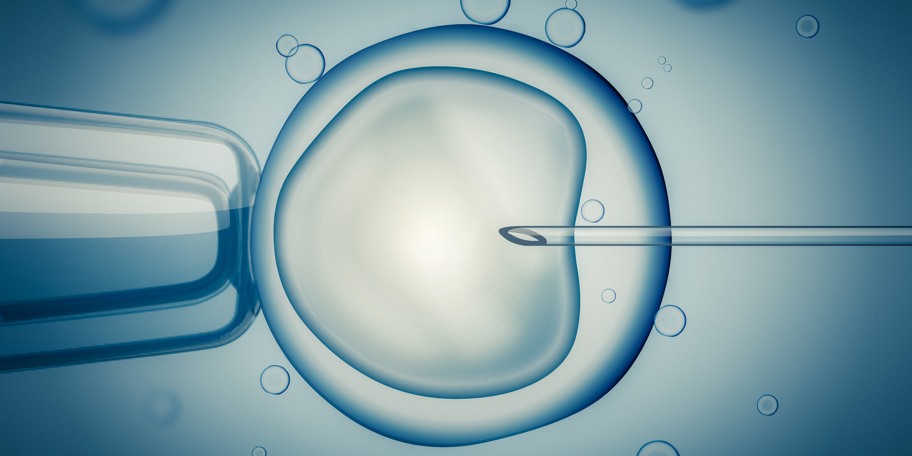 In vitro fertilization (IVF) - Bayi Tabung