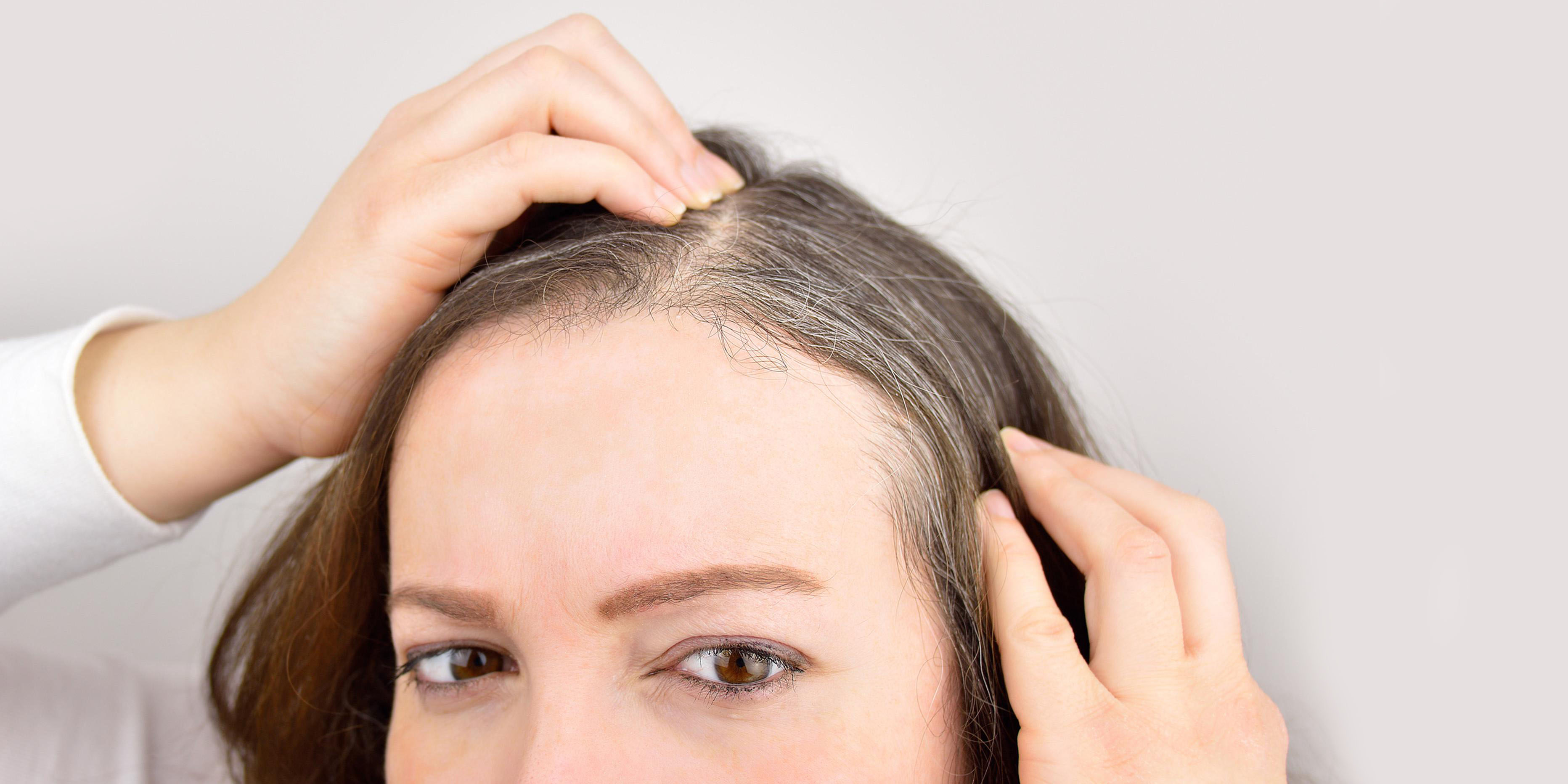 It’s proven: Stress can trigger the appearance of grey hair!