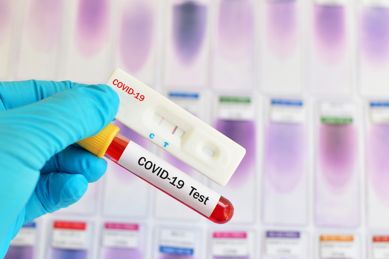 Rapid test or PCR: which one is better?